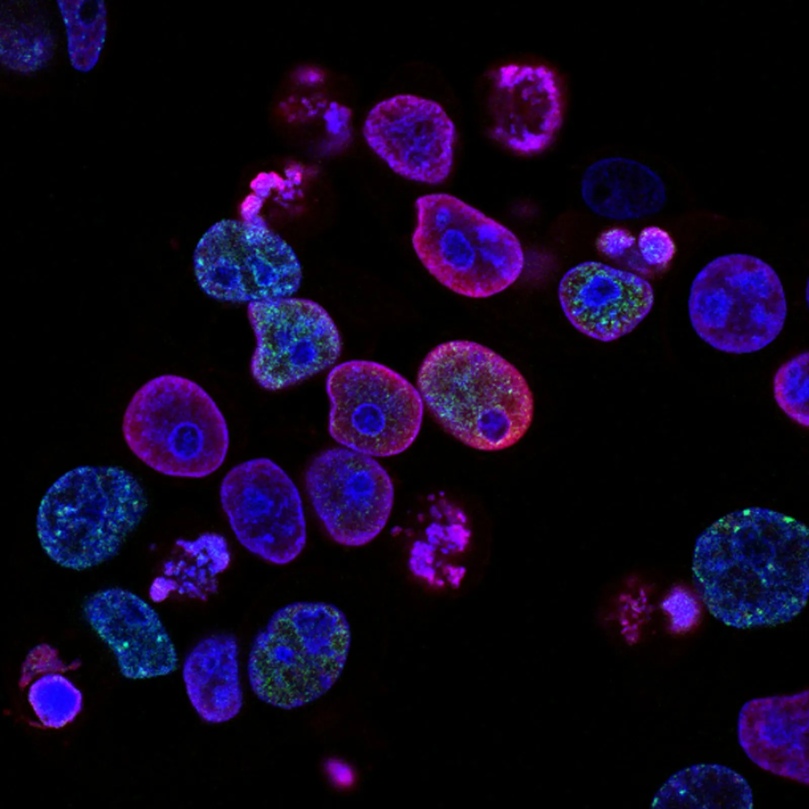 Células vistas al microscopio de fluorescencia